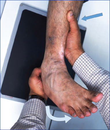 Foot And Ankle Examination | Musculoskeletal Key