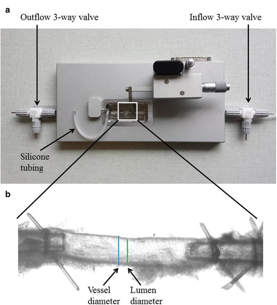 A318721_1_En_19_Fig2_HTML.jpg