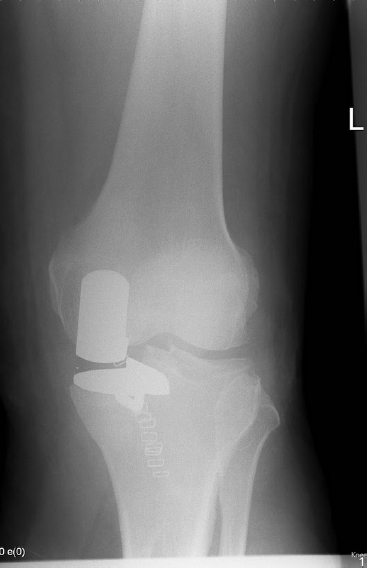 orthopaedics and Pathology | Musculoskeletal Key