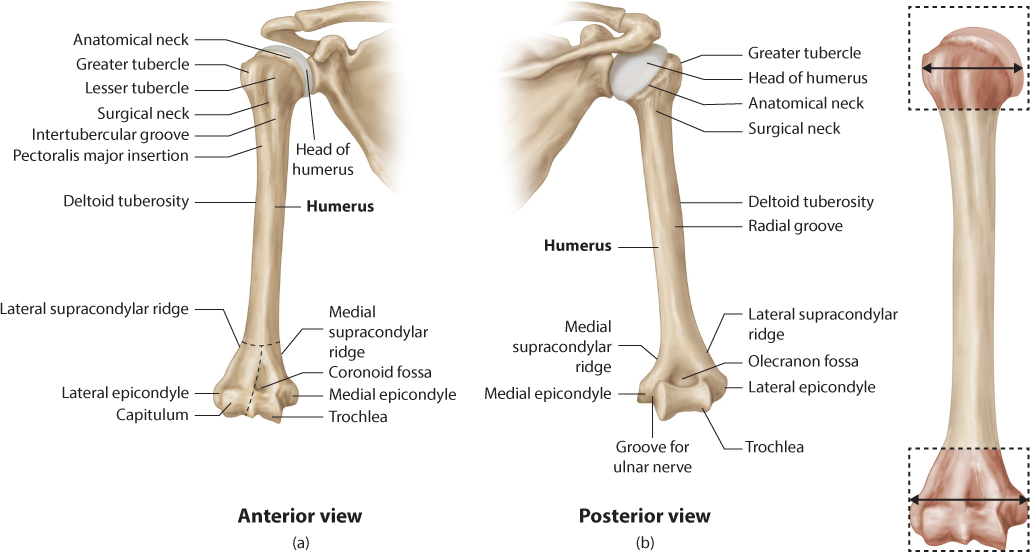 Humeral diaphyseal fractures | Musculoskeletal Key
