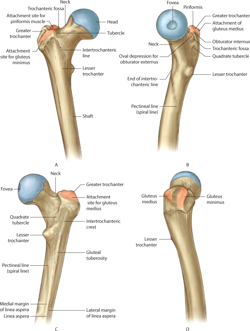 proximal femur fracture