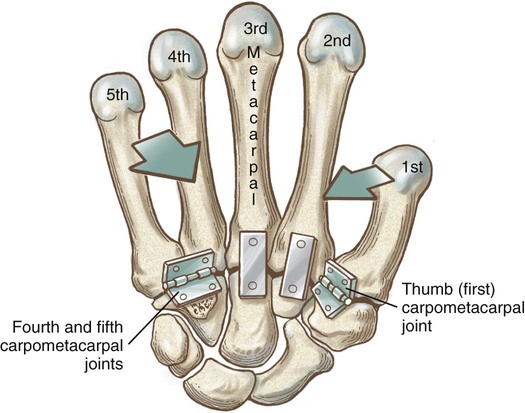 Structure and Function of the Hand | Musculoskeletal Key