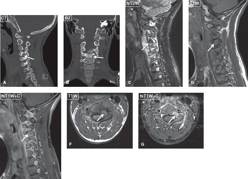 Bone And Soft Tissue Tumors Musculoskeletal Key