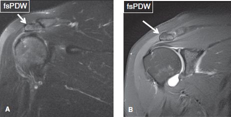 The Shoulder | Musculoskeletal Key