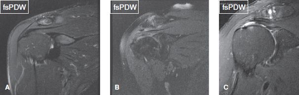 The Shoulder | Musculoskeletal Key