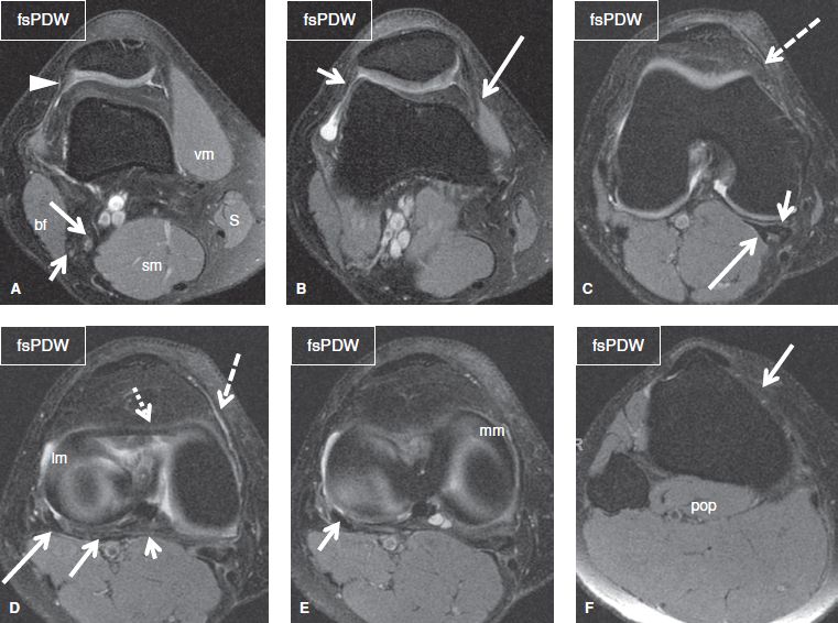 The Knee Musculoskeletal Key