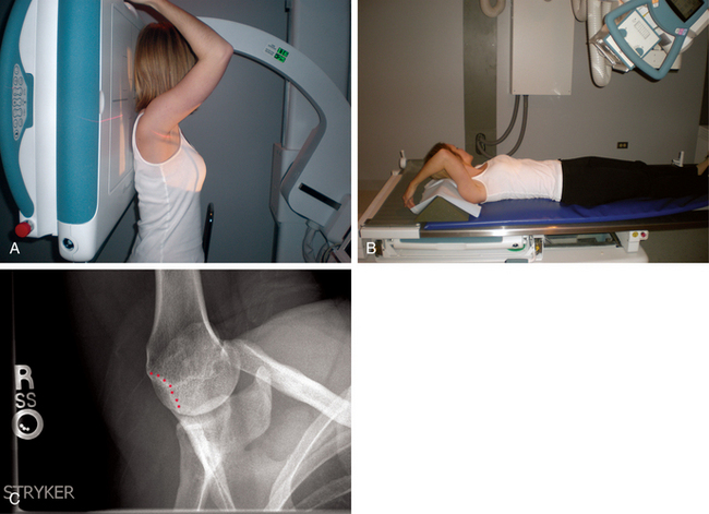 This view can be obtained with the patient either standing (A) or in the su...