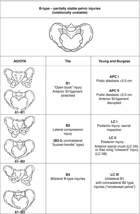 Pelvic Fractures  Musculoskeletal Key