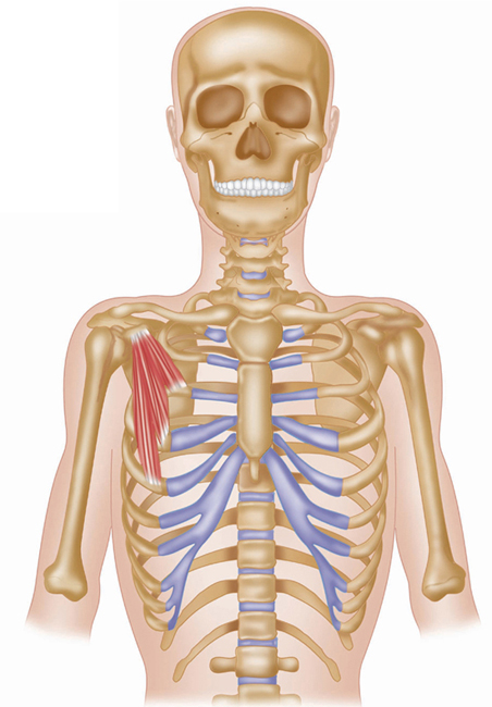 The Muscles Of The Shoulder And Upper Arm By, Pain In Upper Arm Muscle