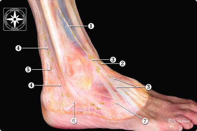 Arthroscopic Anatomy | Musculoskeletal Key