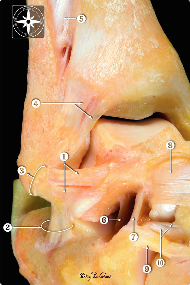 anterior talofibular ligament