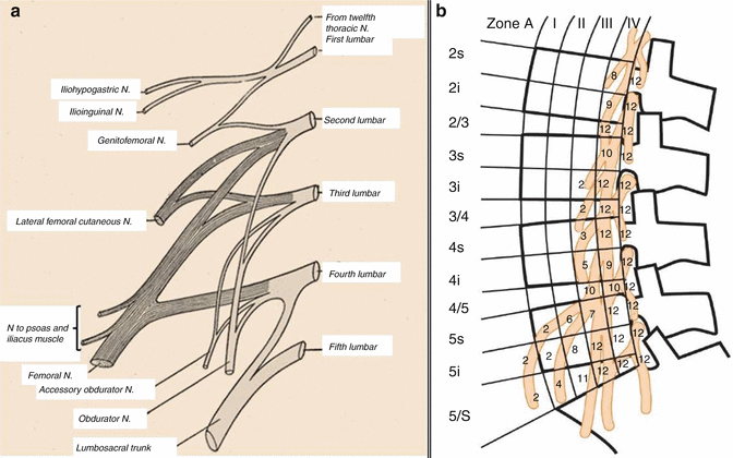 Interbody Fusion Through The Transpsoas Approach | Musculoskeletal Key