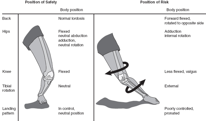 Traumatic Knee Injuries | Musculoskeletal Key