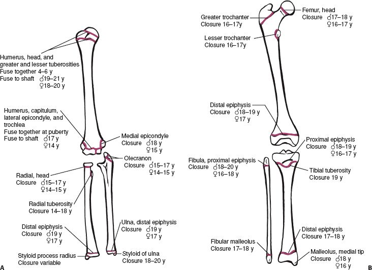 Physeal Injuries And Growth Disturbances | Musculoskeletal Key