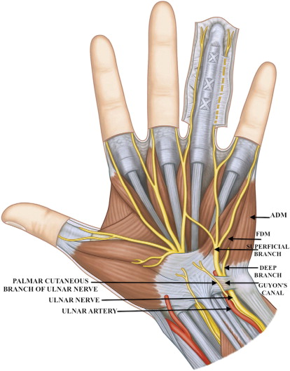 Ulnar Tunnel Syndrome | Musculoskeletal Key