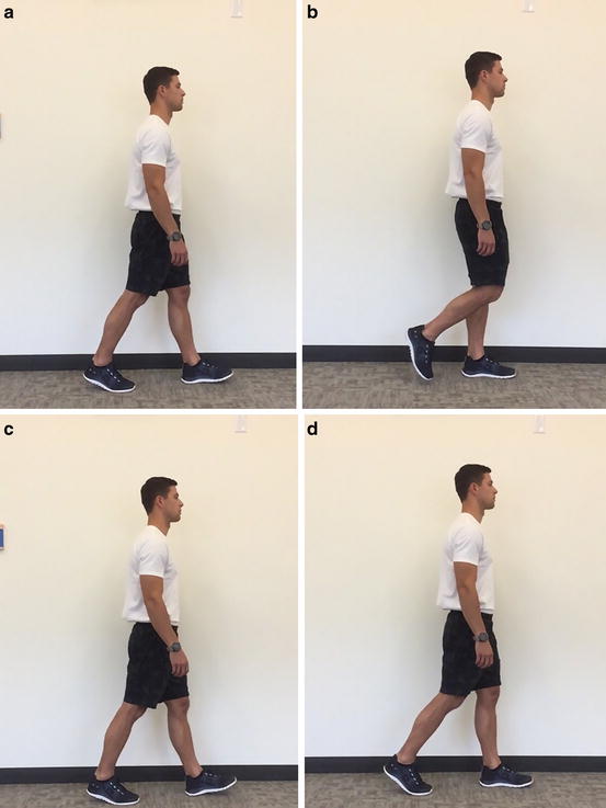 Gait Assessment | Musculoskeletal Key