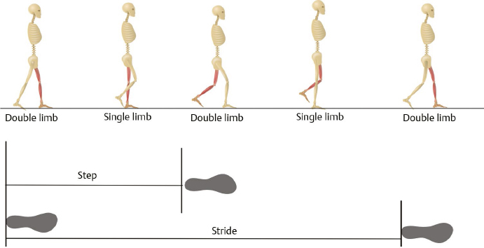 Amputations And Rehabilitation | Musculoskeletal Key