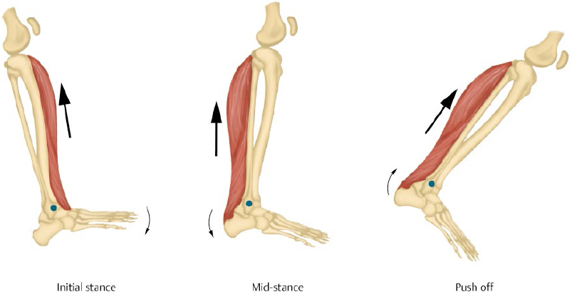 Amputations And Rehabilitation | Musculoskeletal Key