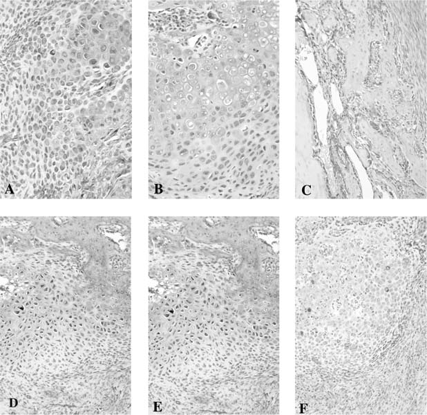 Biology And Biomechanics Of Fracture Healing | Musculoskeletal Key