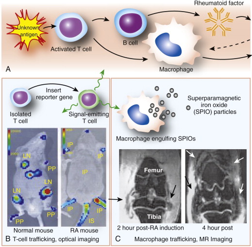 MOLECULAR IMAGING OF RHEUMATOID ARTHRITIS AND OSTEOARTHRITIS ...