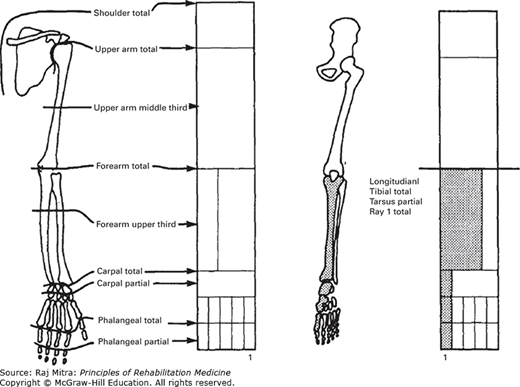 Issues In Pediatric Amputations | Musculoskeletal Key