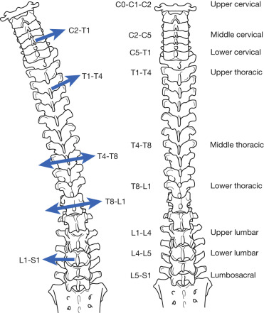 Spinal Orthoses | Musculoskeletal Key