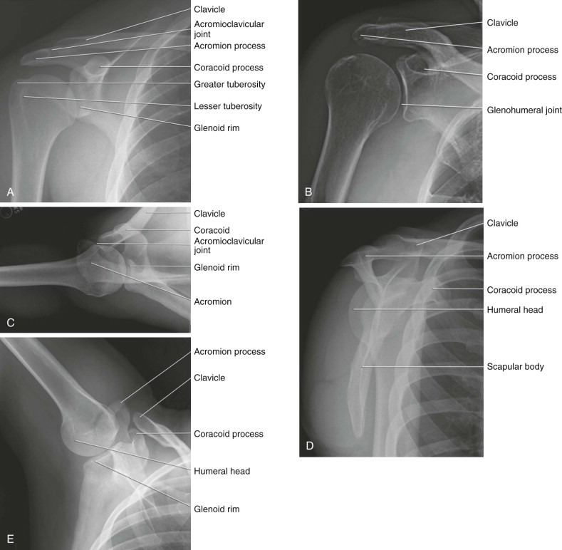 Glenohumeral Joint Imaging | Musculoskeletal Key