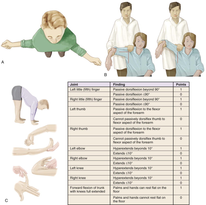 Anterior Shoulder Instability | Musculoskeletal Key