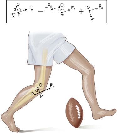 Extensor Mechanism Injuries Of The Knee | Musculoskeletal Key