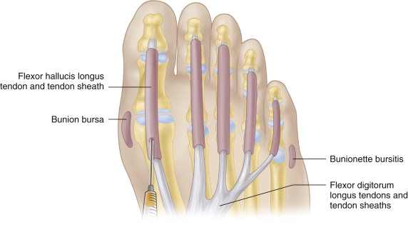 THE ANKLE AND FOOT | Musculoskeletal Key