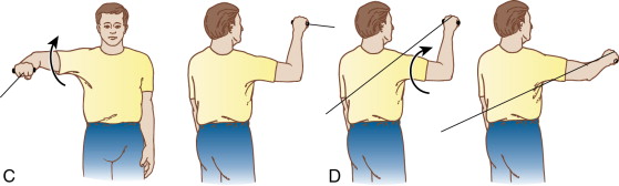 Throwers’ Ten Exercise Program | Musculoskeletal Key