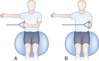 Advanced Throwers’ Ten Program | Musculoskeletal Key