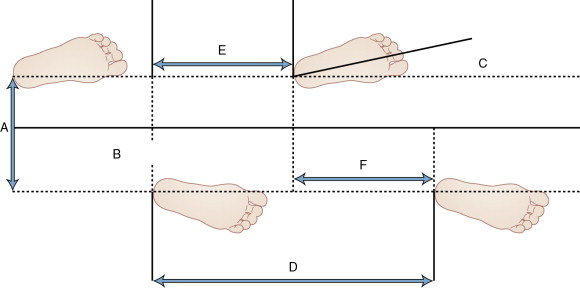 Clinical Gait Assessment | Musculoskeletal Key