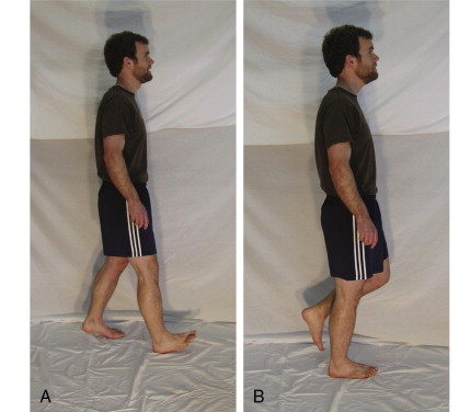 Clinical Gait Assessment | Musculoskeletal Key