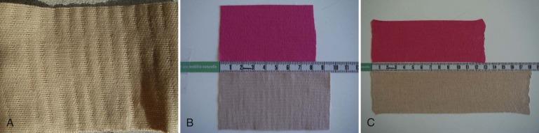 Elastic Taping Kinesio Taping Method Musculoskeletal Key