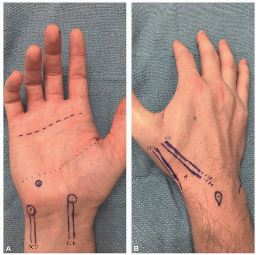 Hand And Wrist Anatomy | Musculoskeletal Key