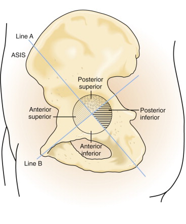 Neurovascular Injury | Musculoskeletal Key