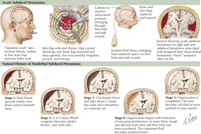 Head Injuries | Musculoskeletal Key