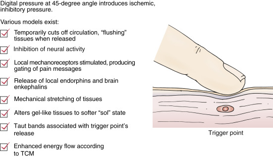 Myofascial Pain Syndrome | Musculoskeletal Key