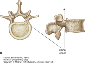 Low Back Pain | Musculoskeletal Key