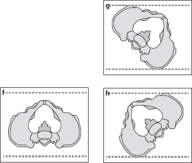 Lumbar Assessment | Musculoskeletal Key