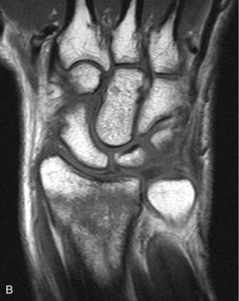 Imaging Of The Musculoskeletal System | Musculoskeletal Key