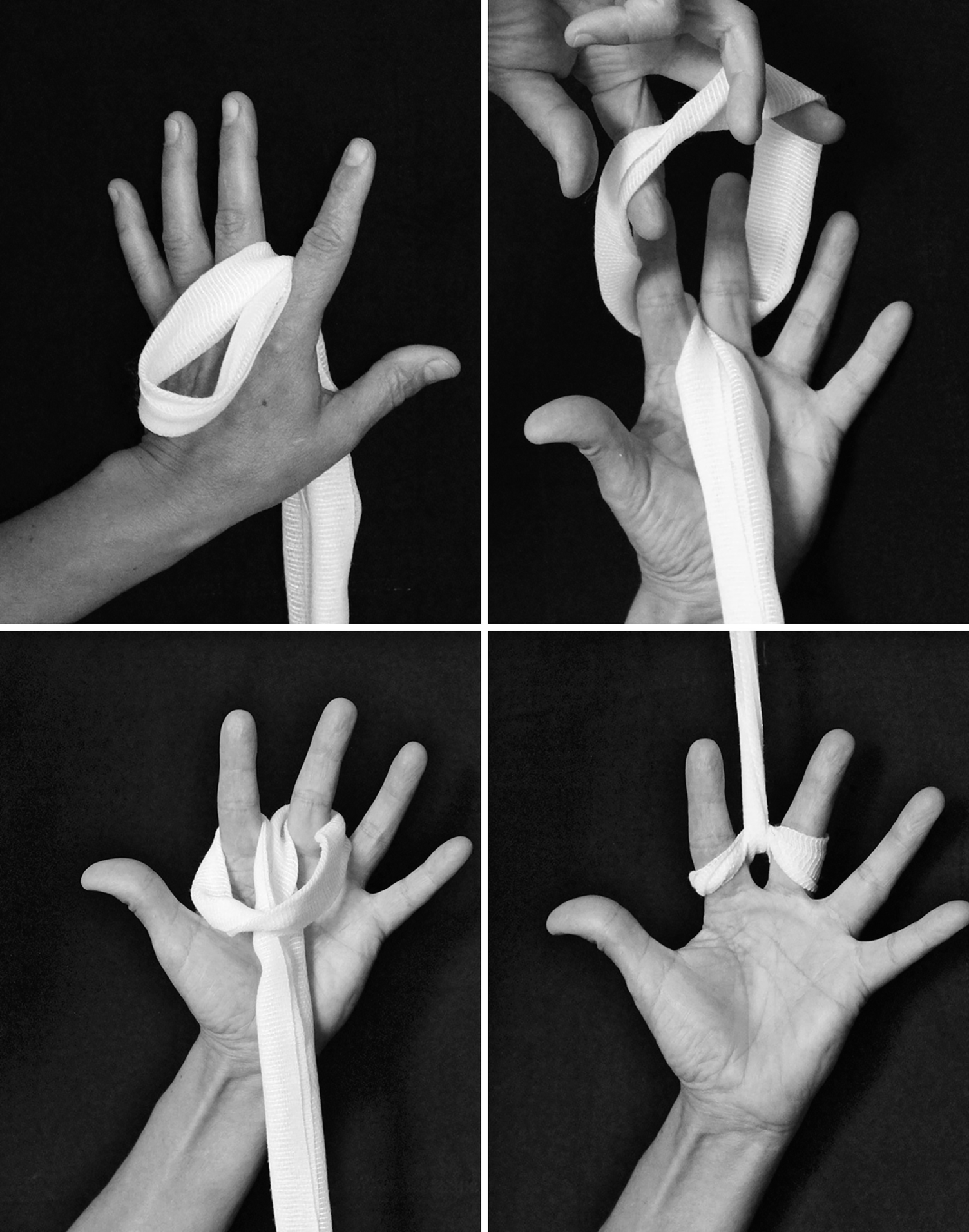 Of The Hand And Wrist | Musculoskeletal Key