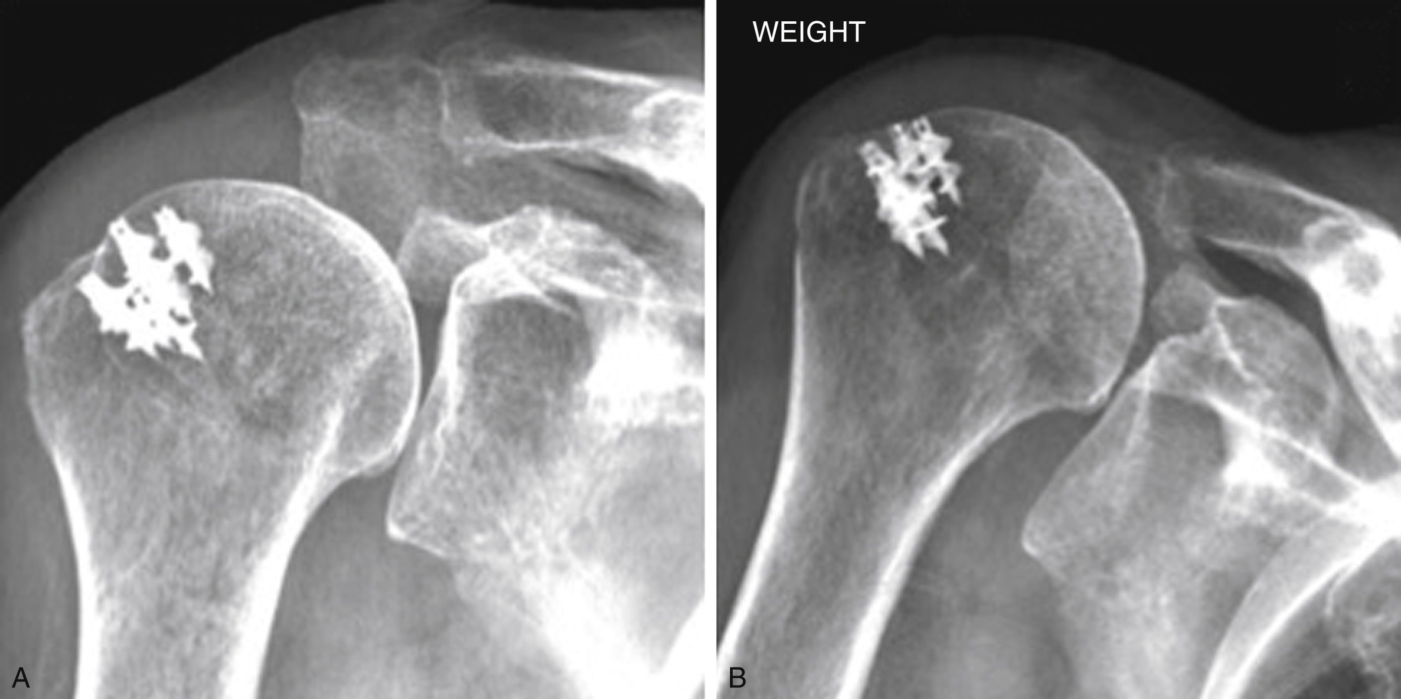 Imaging For Rotator Cuff Pathology | Musculoskeletal Key