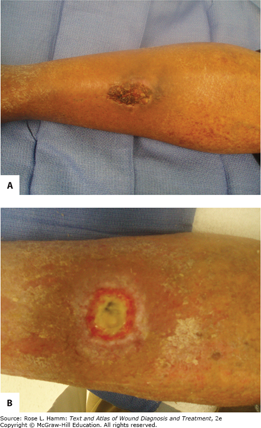 Examination And Evaluation Of The Patient With A Wound ...