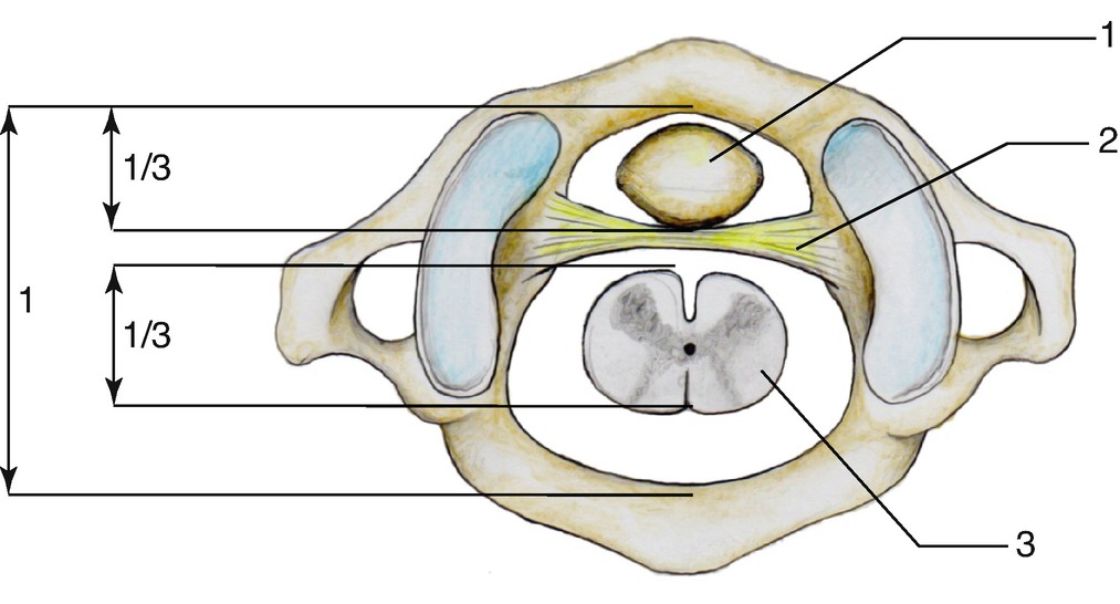 Spinal Canal | Musculoskeletal Key