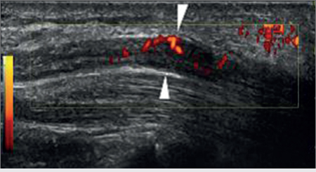 1 Diagnostic Ultrasound And Guided Injection | Musculoskeletal Key