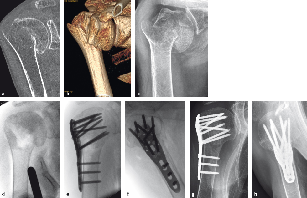 1.2 Principles Of Orthogeriatric Surgical Care | Musculoskeletal Key