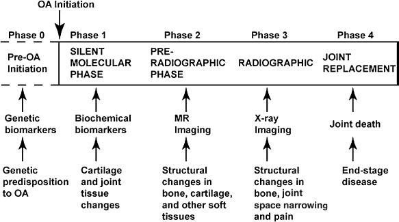 Evolving Biomarkers In Osteoarthritis | Musculoskeletal Key