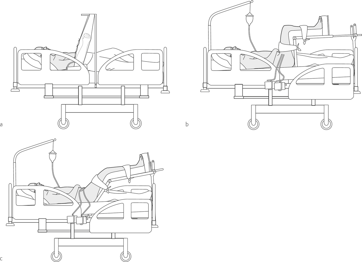 Postoperative Management | Musculoskeletal Key